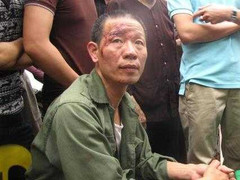 Bộ Công an: Làm rõ vụ CA bị tố vụt dùi cui vào dân