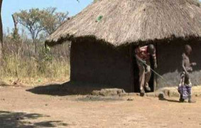 Những đứa trẻ mắc hội chứng “thây ma sống”