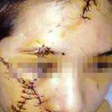 Điều tra vụ dùng lưỡi lam đánh ghen bạn gái thân