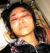 Cô giáo bị 2 kẻ lạ mặt hành hung dã man