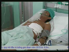 Gặp ngư dân bị cá cờ đâm thủng tim