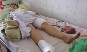 Sập phòng dạy thêm, 2 học sinh nhập viện