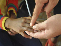 'Bệnh lạ' quái ác có nguyên nhân từ ăn gạo mốc?