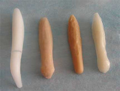 Chọn chất liệu nào để tránh biến chứng khi nâng mũi?