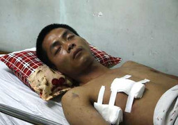 Cướp tiệm vàng ở Hưng Yên: Một nạn nhân đã xuất viện