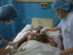 Đâm người yêu rồi thiêu cháy cả hai người