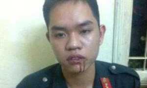 Vụ nữ sinh đánh CSCĐ: Choáng váng sau cú đấm bất ngờ