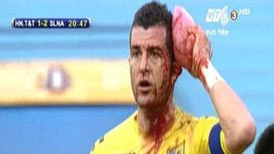 Trận quyết đấu ở Hàng Đẫy: Máu đã đổ