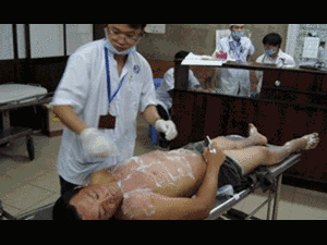 Nổ khí gas ở Bình Dương: Thêm nạn nhân tử vong