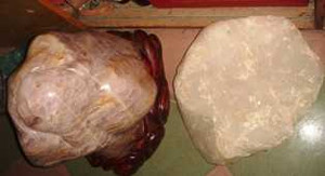 Bé gái gây cháy: Chính quyền nói gì?