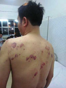 Mâu thuẫn làm ăn, bị đánh trọng thương