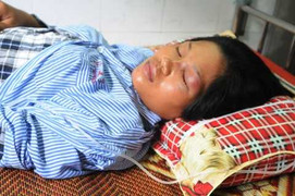 CSGT vụt dùi cui, làm sưng mặt người vi phạm