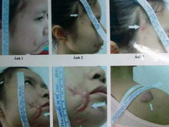 Kháng nghị tăng án kẻ chích điện vợ đang mang thai