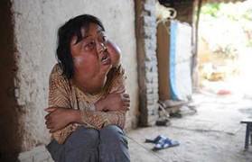 Xót xa người phụ nữ mang khuôn mặt 'quái vật'