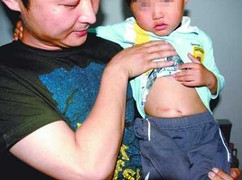 Ăn thạch rau câu, bé trai 5 tuổi bị tắc ruột