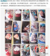 Trung Quốc: Tranh chấp hồ cá, cán bộ chém dân