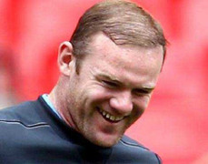 Bỏ tiền tỉ cấy tóc, Rooney sắp... hói trở lại