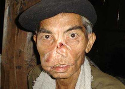 “Vua diệt sói dữ” và cuộc đời tàn phế trong ân hận