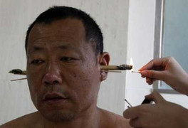 Thức đêm xem bóng đá quá nhiều: Coi chừng liệt cơ mặt