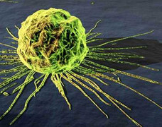 Phụ nữ trẻ thụ tinh trong ống nghiệm: Nguy cơ ung thư