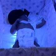 Ca sinh 4 hiếm gặp tại Bệnh viện Từ Dũ