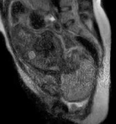 Lần đầu tiên quay được hình ảnh đứa trẻ ra đời