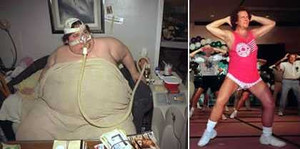 Những câu chuyện giảm béo kỳ lạ (phần 2)