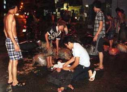 Chấn thương sọ não sau khi uống rượu lái xe