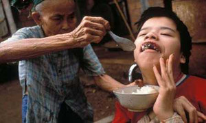 Phát động nhắn tin ủng hộ nạn nhân da cam qua 1400