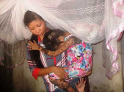 Chùm ảnh: Đau lòng bé gái ‘người thú’