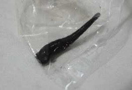 Con vắt dài gần 5cm trong khí quản bé 6 tuổi