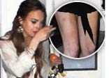 Lindsay Lohan lộ làn da loang lổ