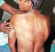 Nam sinh tố bị 3 giáo viên đánh đập, ép uống nước tiểu