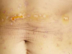 Chữa bệnh bằng chích nhang, đá vào vùng kín