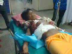 Bé trai 12 tuổi bị trâu húc thương tâm