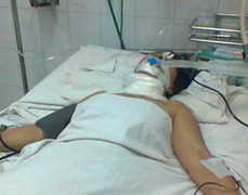 Truy tìm nam thanh niên đánh bạn gái dã man