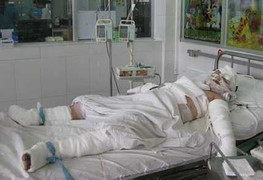 Đang sửa, xe máy bốc cháy khiến chủ nhân bỏng toàn thân