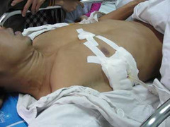 Viện phí tăng: Bảo hiểm tăng theo thế nào?