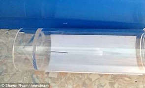 Y tá bỏ quên kim tiêm trong chân bé 4 tuổi