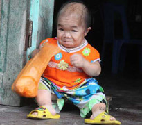 Gia đình có 2 con bị bệnh lạ: 22 tuổi như trẻ lên 3