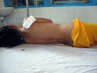 Bé gái 8 tuổi bị chó becgiê cắn khắp người