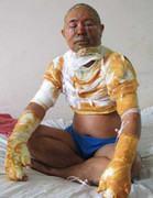 Nhân viên quán lẩu ném bình cồn vào người khách