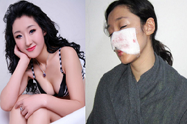 Sự thật vụ nữ diễn viên bị chó ngao cắn rách mặt