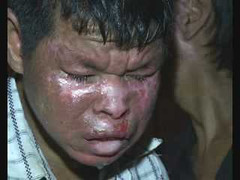 Video: Gặp lại những người bệnh khủng khiếp ở Hoà Bình