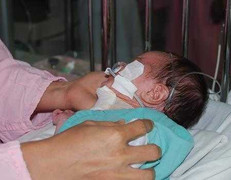 Bố ‘trượt tay’ khiến bé sơ sinh chấn thương não