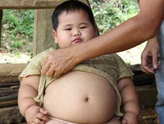 Bé trai 2 tuổi khổng lồ ở Hòa Bình: Quá bất thường!