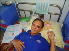 Thanh Hóa: Trưởng thôn đánh dân nhập viện