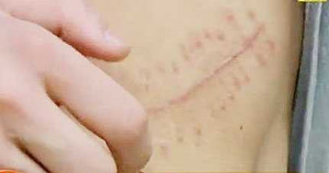 Lơ ngơ bán thận 70 triệu đồng, không cần biết hệ lụy