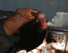 Hà Nội: Bắt kẻ vào nhà đánh trọng thương người dân