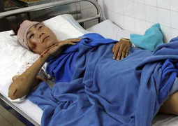 Nữ hoàng điền kinh VN bị xe đâm gãy chân